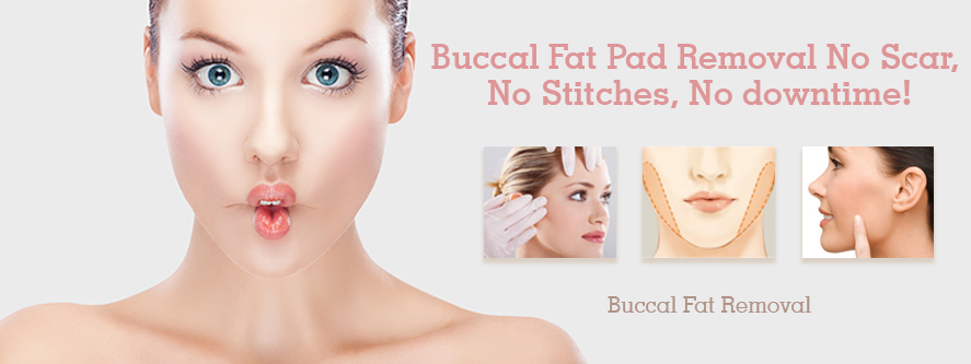 buccal-fat-removal