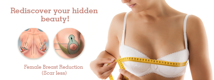 female-breast-reduction