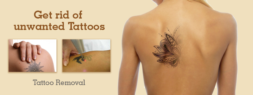 Tattoo Removal Home Remedies Natural  Permanent  9jafoods