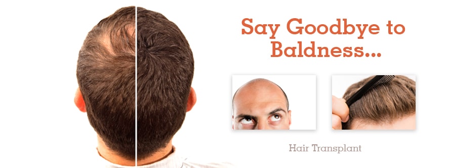 NATURAL REMEDIES FOR COMBATTING HAIR LOSS