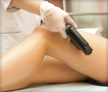 laser_hair_removal